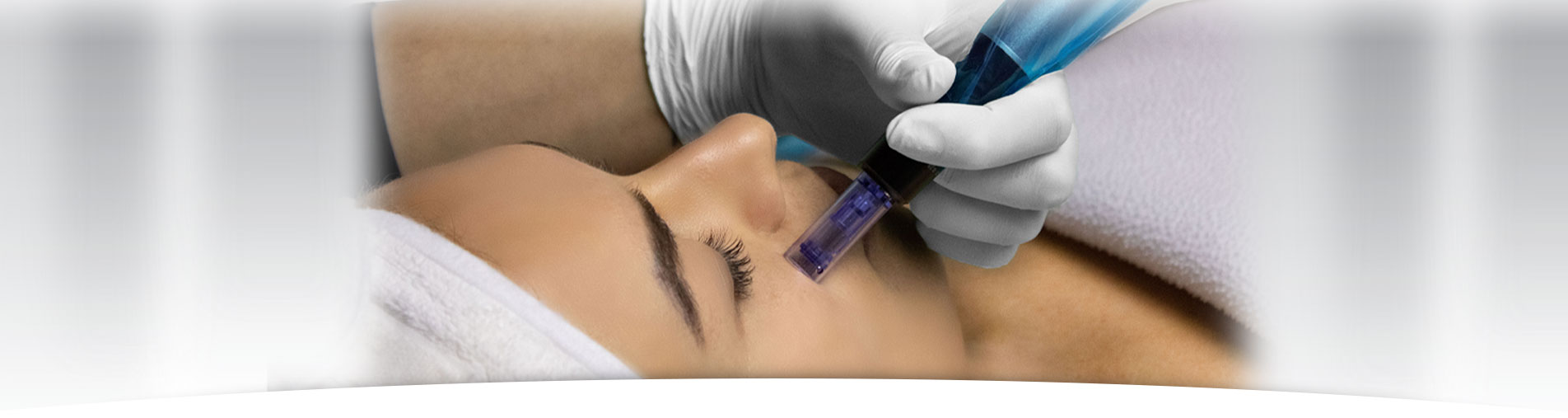 Microneedling mesotherapy