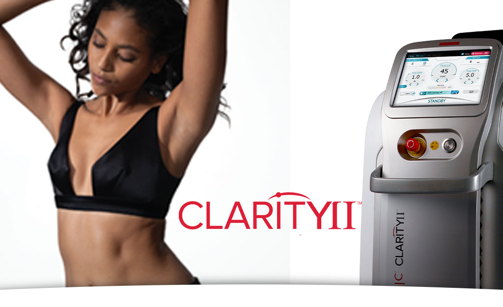 Traitements avec Clarity II